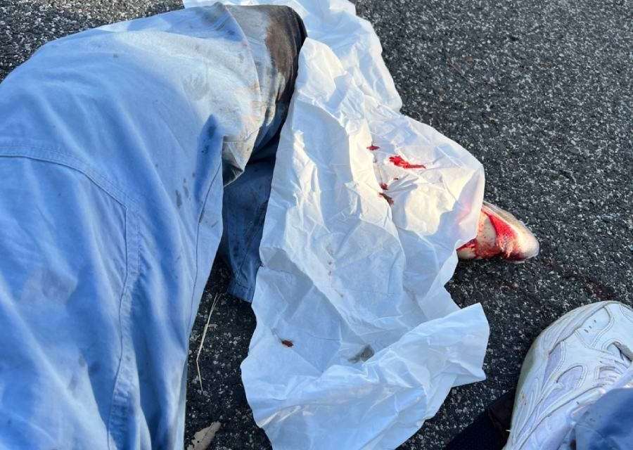 Ferdinando Mezzelani: la foto della sua amputazione racconta la vita e la morte sulle strade di Roma